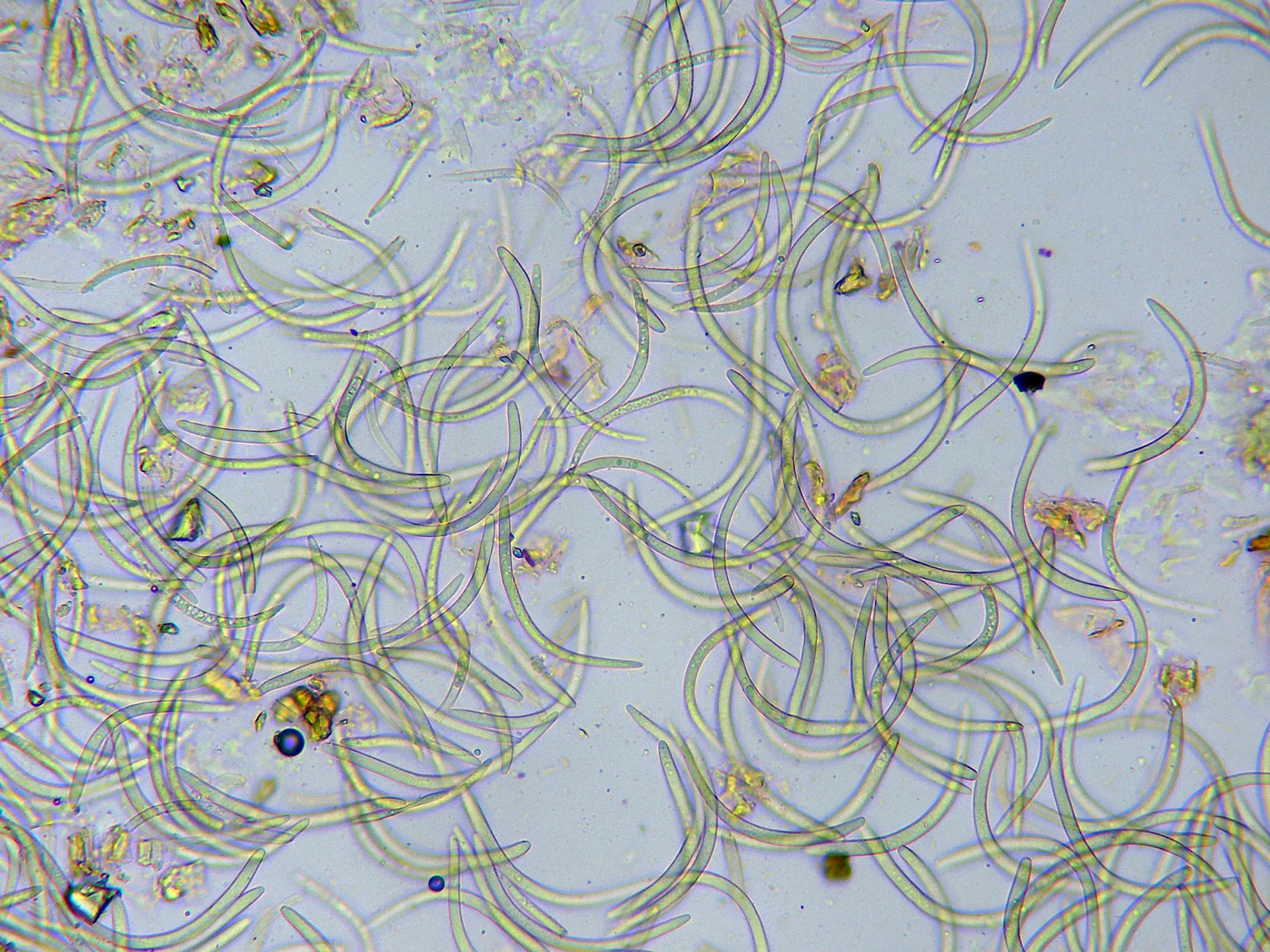 Microscopía de Mycosphaerella pyri - 13 - Conidios x 400-001